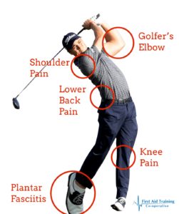 What Are Common Injuries In Golf?